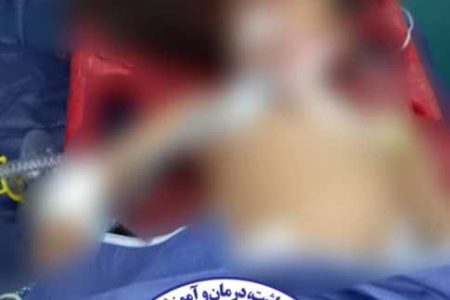 حمله سگ به کودک ۶ ساله در رفسنجان